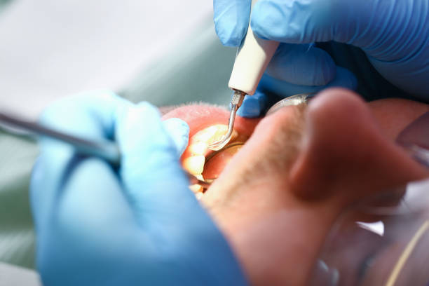 Best Same-Day Emergency Dentist in Green Oaks, IL